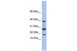 WB Suggested Anti-NDUFC1 Antibody Titration: 0. (NDUFC1 Antikörper  (Middle Region))