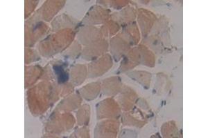 Immunohistochemistry (Paraffin-embedded Sections) (IHC (p)) image for anti-Protein Kinase, AMP-Activated, gamma 3 Non-Catalytic Subunit (PRKAG3) (AA 238-467) antibody (ABIN2922020)