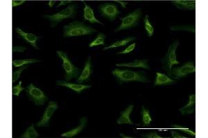 Immunofluorescence of monoclonal antibody to YWHAG on HeLa cell. (14-3-3 gamma Antikörper  (AA 1-247))