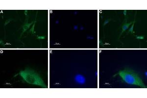 Expression of neuropeptide Y1 receptor in DRG neurons - Immunocytochemical staining of a primary culture of rat dorsal root ganglion (DRG) neurons. (NPY1R Antikörper  (AA 237-252))