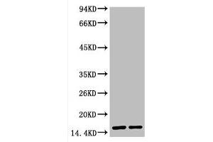 Western blot analysis of Hela, diluted at 1) 1:2000 2) 1:5000 (COX IV Antikörper)