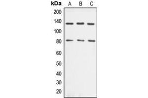 Western blot analysis of Alpha-adducin expression in Jurkat (A), HeLa (B), NIH3T3 (C) whole cell lysates.