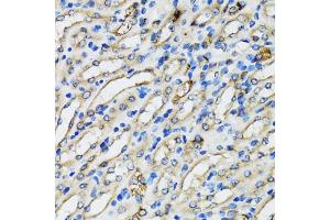 Immunohistochemistry of paraffin-embedded mouse kidney using COPB2 antibody (ABIN5974232) at dilution of 1/100 (40x lens). (COPB2 Antikörper)