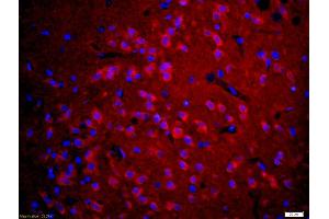 Formalin-fixed and paraffin embedded rat brain labeled with Anti-5HT3A Receptor/SR-3A Polyclonal Antibody, Unconjugated (ABIN1386182) at 1:200 followed by conjugation to the secondary antibody Goat Anti-Rabbit IgG, Cy3 conjugated used at 1:200 dilution for 40 minutes at 37°C and DAPI staining (Serotonin Receptor 3A Antikörper  (AA 31-130))