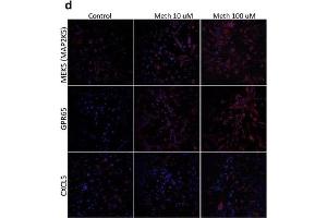 Validation of selected upregulated genes. (CXCL5 Antikörper  (AA 51-132))