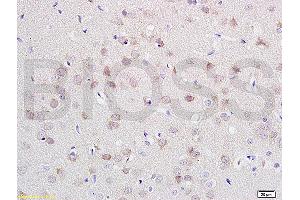 Formalin-fixed and paraffin embedded rat brain labeled with Anti-CDH2/N-cadherin Polyclonal Antibody, Unconjugated (ABIN738726) at 1:200 followed by conjugation to the secondary antibody and DAB staining.
