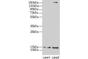 Western blot All lanes: CRABP1 antibody at 4 μg/mL Lane 1: Mouse eye tissue Lane 2: THP-1 whole cell lysate Secondary Goat polyclonal to rabbit IgG at 1/10000 dilution Predicted band size: 16 kDa Observed band size: 16 kDa (CRABP1 Antikörper  (AA 2-137))