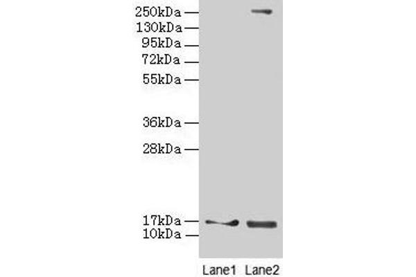 CRABP1 抗体  (AA 2-137)