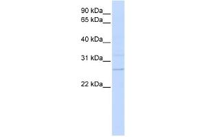 WB Suggested Anti-TMEM126B Antibody Titration:  0. (TMEM126B Antikörper  (N-Term))