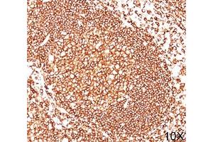 IHC testing of human tonsil (10X) stained with CD45 antibody cocktail (2B11 + PD7/26). (CD45 Antikörper)
