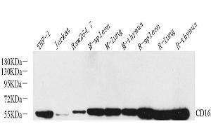 Western Blot analysis of various samples using FCGR3A Polyclonal Antibody at dilution of 1:800. (FCGR3A Antikörper)