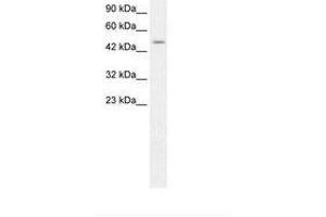 Image no. 1 for anti-Zinc Finger Protein 365 (ZNF365) (AA 75-124) antibody (ABIN203152) (ZNF365 Antikörper  (AA 75-124))