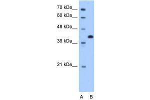 TOR2A antibody used at 1. (TOR2A Antikörper  (N-Term))