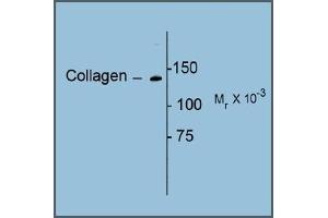 Image no. 1 for anti-Collagen, Type I (COL1) antibody (ABIN372600) (Collagen Type I Antikörper)