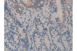 Immunohistochemistry (IHC) image for anti-serpin Peptidase Inhibitor, Clade B (Ovalbumin), Member 1 (SERPINB1) (AA 184-368) antibody (ABIN7435499)