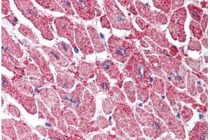 Human Heart (formalin-fixed, paraffin-embedded) stained with KPNA3 antibody ABIN337019 at 5 ug/ml followed by biotinylated anti-goat IgG secondary antibody ABIN481715, alkaline phosphatase-streptavidin and chromogen. (KPNA3 Antikörper  (AA 509-521))