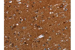 The image on the left is immunohistochemistry of paraffin-embedded Human brain tissue using ABIN7192423(SLC22A12 Antibody) at dilution 1/20, on the right is treated with synthetic peptide. (SLC22A12 Antikörper)
