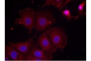 Image no. 2 for anti-Receptor tyrosine-protein kinase erbB-2 (ErbB2/Her2) (pTyr877) antibody (ABIN196748) (ErbB2/Her2 Antikörper  (pTyr877))