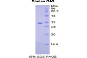 SDS-PAGE analysis of Monkey Carbonic Anhydrase II Protein. (CA2 Protein)