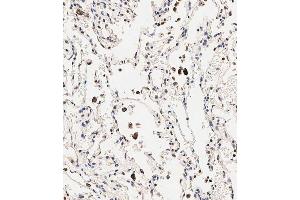 Immunohistochemical analysis of paraffin-embedded human lung tissue using B performed on the Leica® BOND RXm. (Slc6a14 Antikörper  (C-Term))