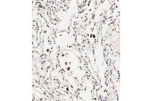 Immunohistochemistry (Paraffin-embedded Sections) (IHC (p)) image for anti-Solute Carrier Family 6 (Amino Acid Transporter), Member 14 (Slc6a14) (AA 602-631), (C-Term) antibody (ABIN656900)