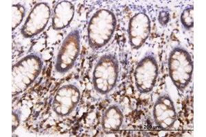 Image no. 3 for anti-B-Cell Receptor-Associated Protein 29 (BCAP29) (AA 125-241) antibody (ABIN599278) (BCAP29 Antikörper  (AA 125-241))