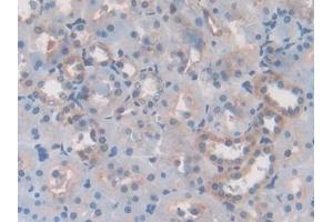 DAB staining on IHC-P; Samples: Rat Kidney Tissue (Laminin beta 3 Antikörper  (AA 503-738))