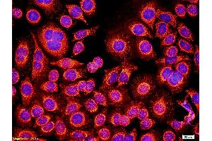 Myeloma cells labeled with Anti-GM-CSFR alpha/CD116/CSF2RA Polyclonal Antibody, Unconjugated (ABIN686812) followed by conjugation to the secondary antibody and DAPI staining