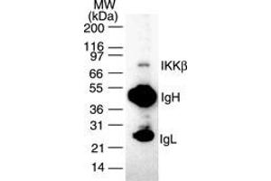 IKK beta IKK2 Western Blot Immunoprecipitation/Western Blot of Mouse Anti-IKK beta antibody.