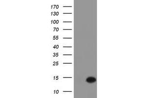 Western Blotting (WB) image for anti-Chromosome 17 Open Reading Frame 37 (C17orf37) antibody (ABIN1501784) (C17orf37 Antikörper)