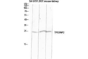 Western Blot (WB) analysis of SH-SY5Y 293T Mouse Kidney lysis using TP53INP2 antibody. (TP53INP2 Antikörper)