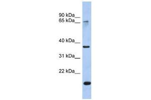 Annexin A10 antibody used at 1 ug/ml to detect target protein. (Annexin a10 Antikörper  (Middle Region))