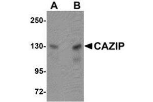 Western blot analysis of CAZIP in A20 cell lysate with AP30208PU-N CAZIP antibody at (A) 0.
