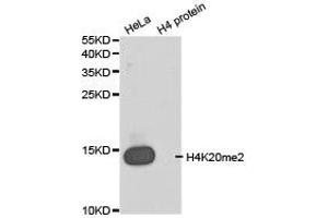 Western blot analysis of extracts of HeLa cell line and H4 protein expressed in E. (Histone 3 Antikörper  (2meLys20))