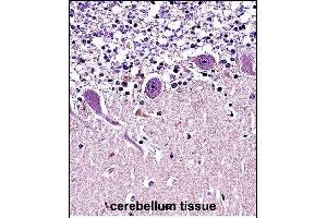 CR Antibody (N-term) (ABIN657682 and ABIN2846674) immunohistochemistry analysis in formalin fixed and paraffin embedded human cerebellum tissue followed by peroxidase conjugation of the secondary antibody and DAB staining.