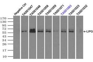 Image no. 1 for anti-Lipase, Endothelial (LIPG) antibody (ABIN1499169)