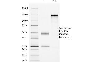 SDS-PAGE Analysis Purified CD16 Mouse Monoclonal Antibody (HuNK2). (FCGR3A Antikörper)