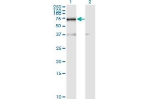 Western Blot analysis of RBM39 expression in transfected 293T cell line by RNPC2 monoclonal antibody (M01), clone 4G8. (RBM39 Antikörper  (AA 423-472))