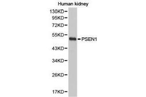 Western Blotting (WB) image for anti-Presenilin 1 (PSEN1) antibody (ABIN1874357) (Presenilin 1 Antikörper)
