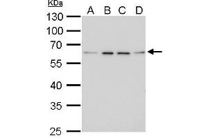 WB Image FGFR-5 antibody detects FGFR-5 protein by Western blot analysis. (FGFRL1 Antikörper)
