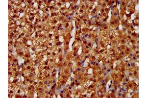 IHC image of ABIN7157812 diluted at 1:200 and staining in paraffin-embedded human adrenal gland tissue performed on a Leica BondTM system. (LARP6 Antikörper  (AA 294-453))