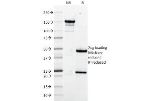 SDS-PAGE Analysis Purified CD106 Monoclonal Antibody (1. (VCAM1 Antikörper)