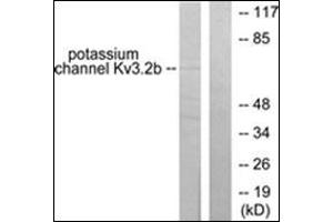 Western blot analysis of extracts from HepG2 cells, using KCNC2 antibody. (KCNC2 Antikörper  (C-Term))