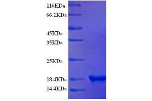 Fatty Acid Binding Protein 3, Muscle and Heart (FABP3) (AA 2-133) protein (His tag)