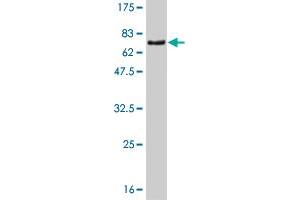 Western Blot detection against Immunogen (66. (ZNF24 Antikörper  (AA 1-368))