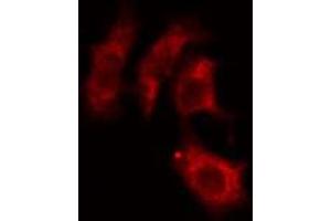 ABIN6274241 staining HepG2 cells by IF/ICC.