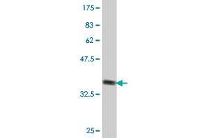 Western Blot detection against Immunogen (37. (ELTD1 Antikörper  (AA 192-292))