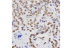 Immunohistochemistry (IHC) image for anti-Histone H4 (2meLys20) antibody (ABIN3016048)
