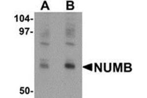 Western blot analysis of NUMB in mouse lung tissue lysate with NUMB antibody at (A) 0. (NUMB Antikörper  (C-Term))