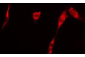 ABIN6266696 staining 293 cells by IF/ICC. (GAK Antikörper  (N-Term))